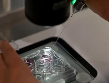 التوثيق السريري المحيطي