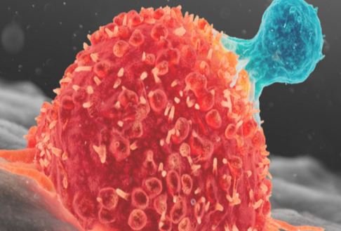 علماء روس يبتكرون فئة جديدة من الأدوية لنزع سلاح الخلايا السرطانية